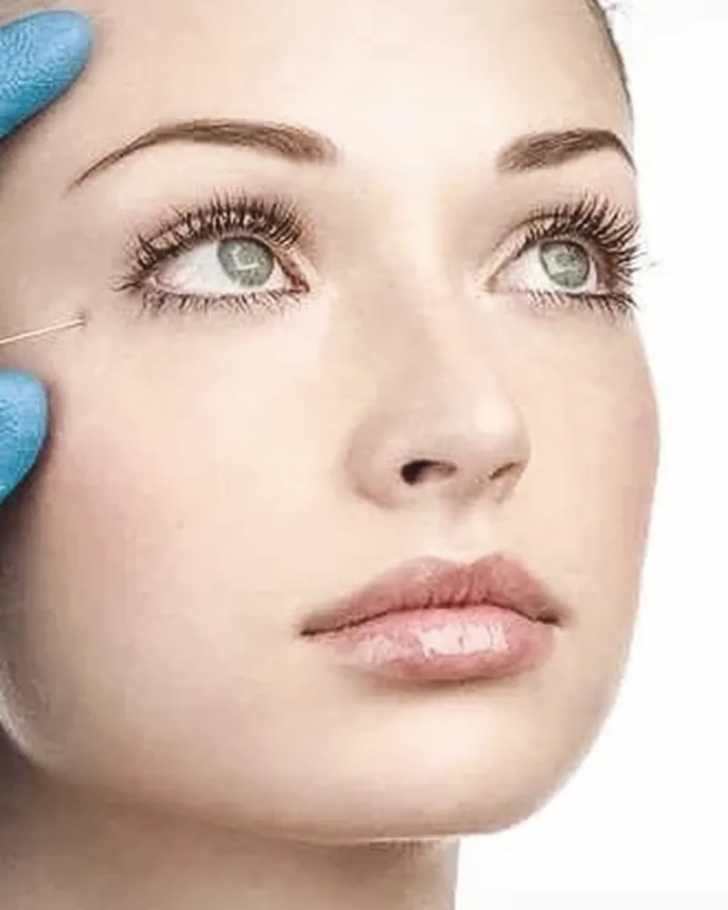 Close-up of a patient during a wrinkle relaxer consultation